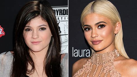 kylie jenner vorher nachher bilder|Kylie Jenner: Die Beauty